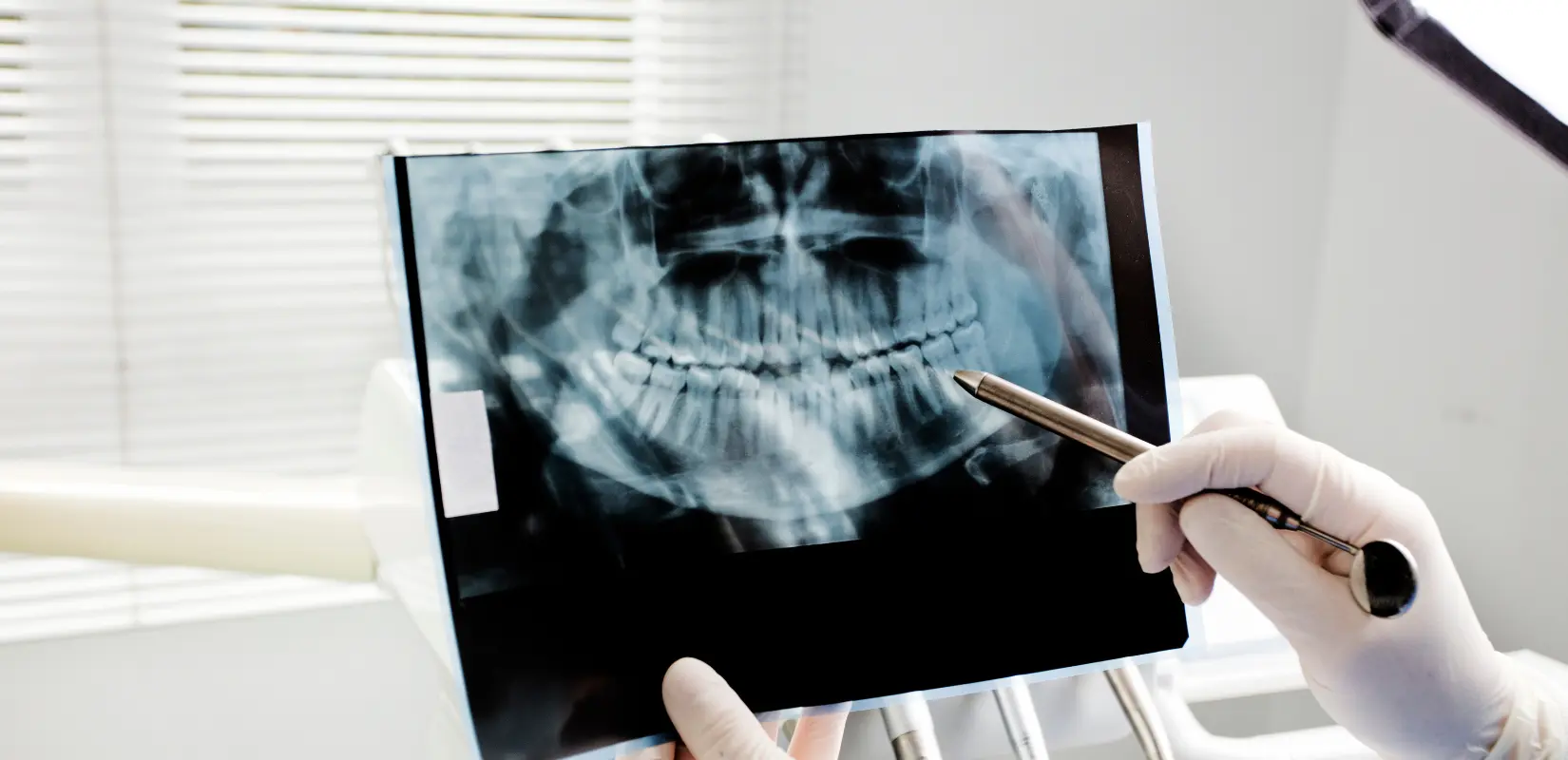 Radiografía panorámica dental revisada durante una consulta de ortodoncia