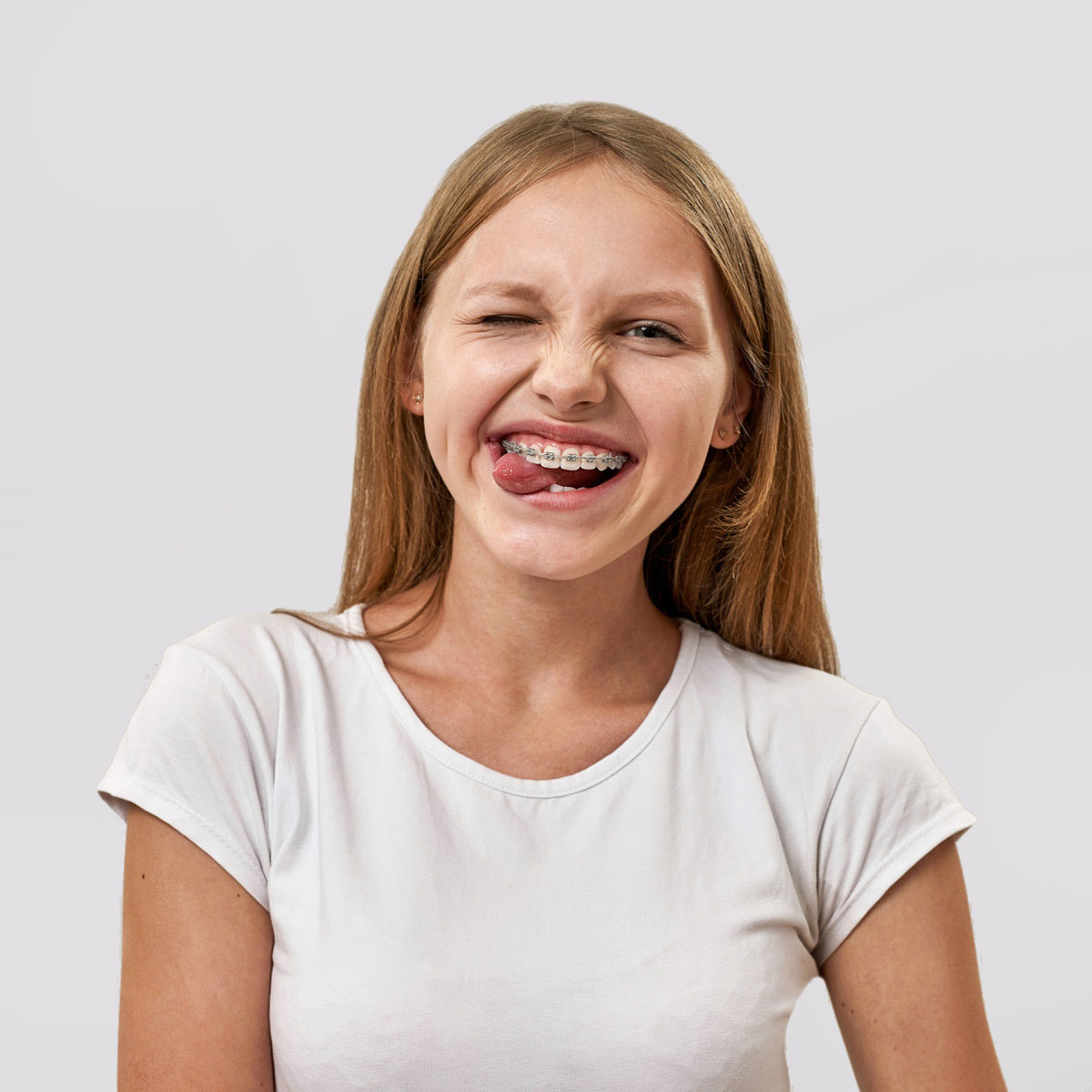 Paciente joven sonriendo con brackets